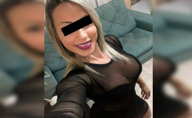 Mujer muere por inyectarse silicona industrial en los glúteos