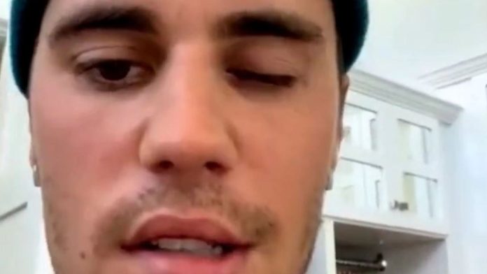 Galería: Filtran supuesto desnudo de Justin Bieber y fans quedan 